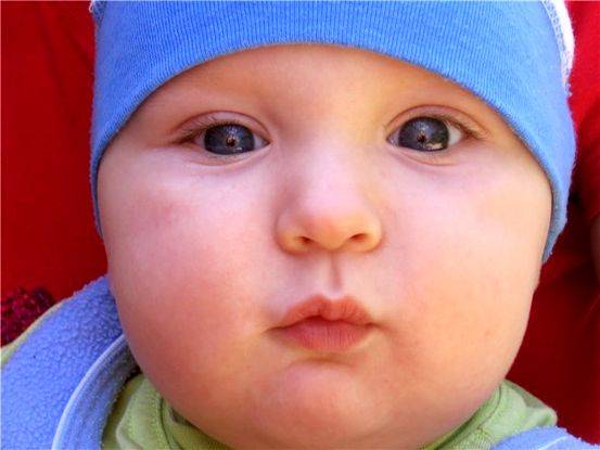 Разные по размеру зрачки у ребенка - причины анизокории | все о болезнях глаз