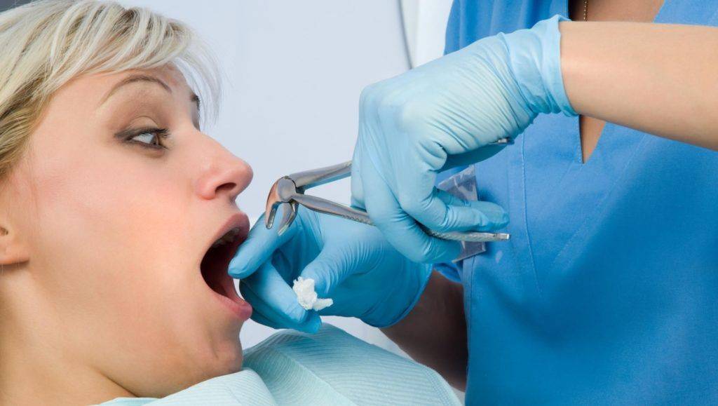 После стоматологического лечения: основные рекомендации