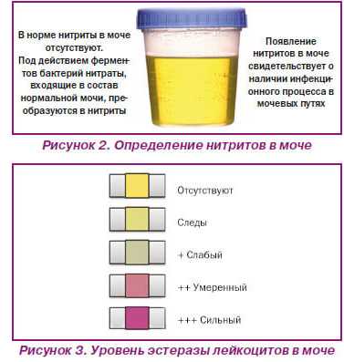 Кровь в моче у детей: причины крови в моче у детей, консультация уролога в москве