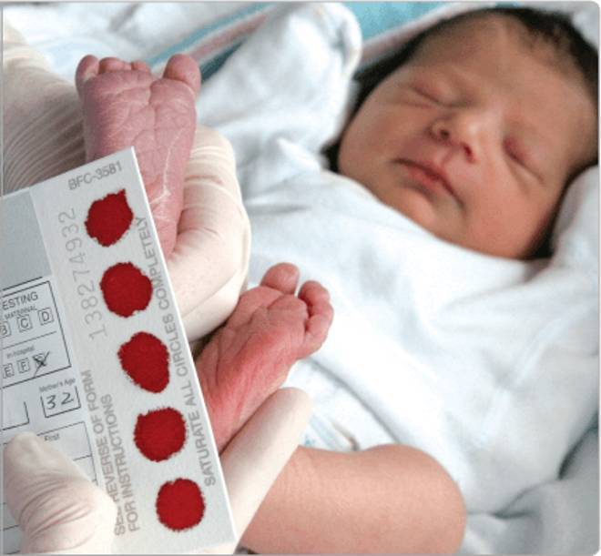 Почему в роддоме у новорожденных берут кровь из пятки: опасно ли это