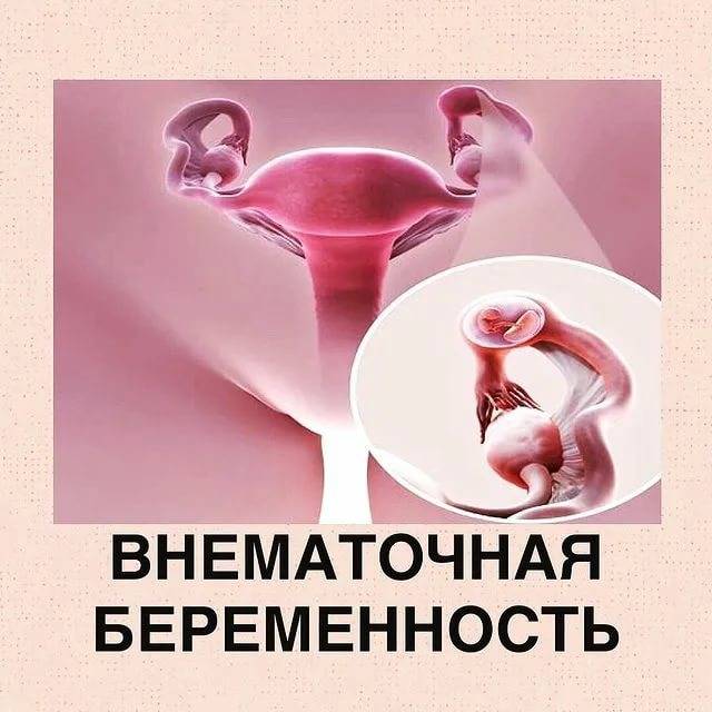 Перевязка маточных труб – цена на операцию женской стерилизации в санкт-петербурге
