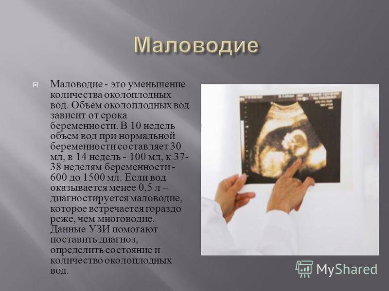 Маловодие при беременности: причины и последствия, чем опасно, лечение - medside.ru