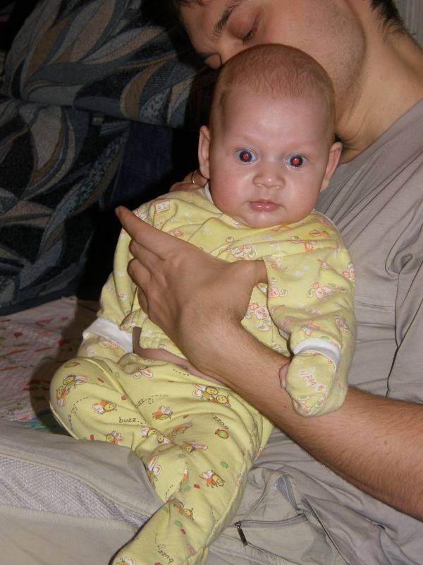Посинение носогубного треугольника у ребенка фото