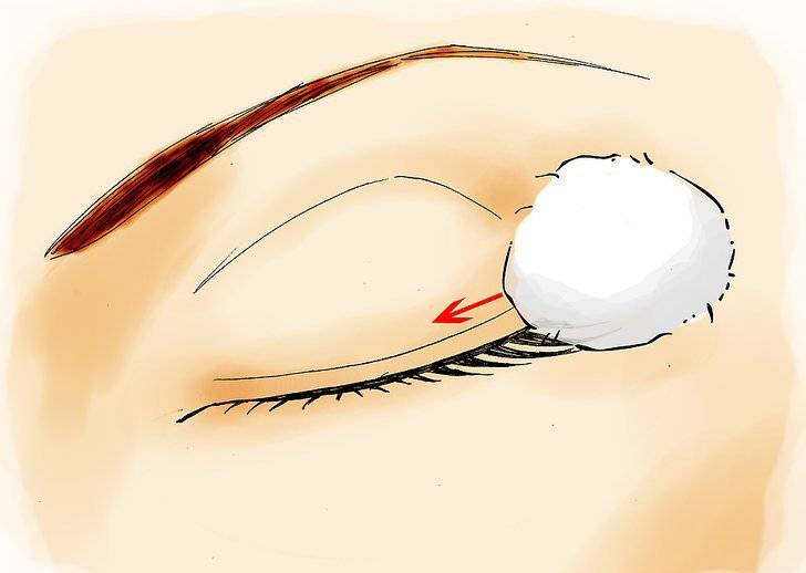 Как вытащить ресницу из глаза у грудничка: способы достать волос