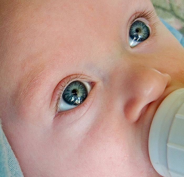Врожденная катаракта. симптомы, причины и лечение.