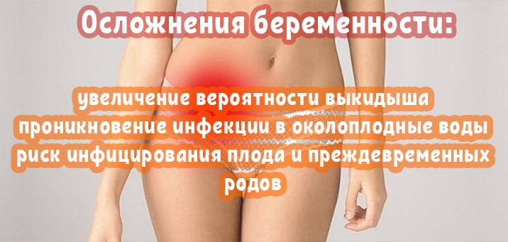 Дрожжевой кольпит: что это такое, лечение – причины, последствия дрожжевого кольпита при беременности — медицинский женский центр в москве