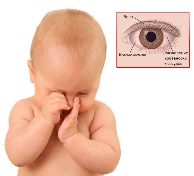 Почему ребенок чешет глаза и нос руками, возможные причины