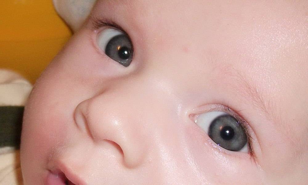 Когда происходит изменение цвета глаз у детей