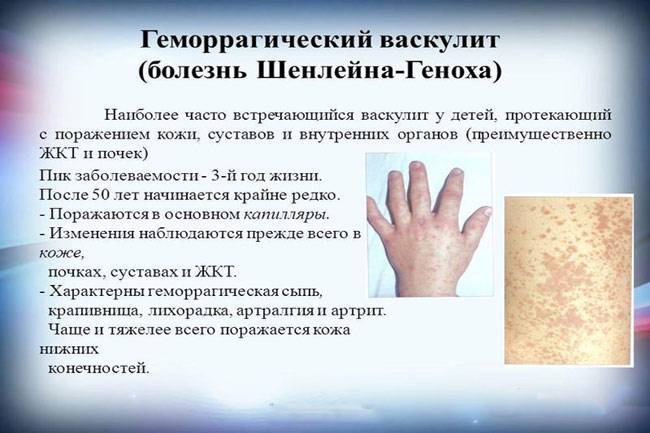 Чернобровкина т.я диагностическое значение экзантем при инфекционных заболеваниях
 - vmc verte medical clinic