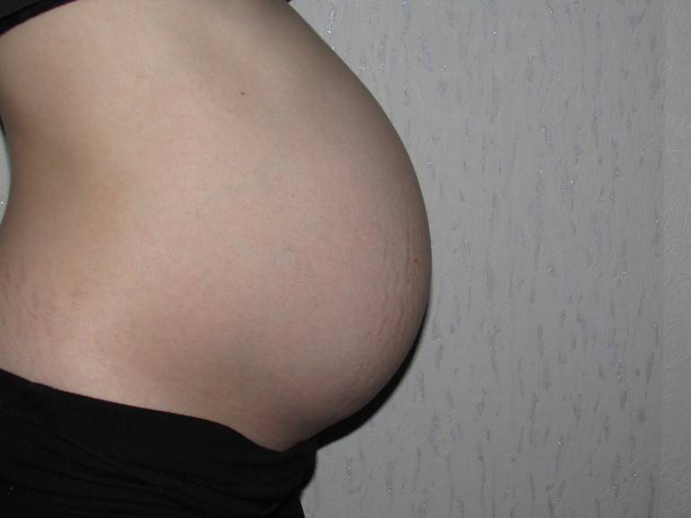 Последствия родов в 36 недель беременности