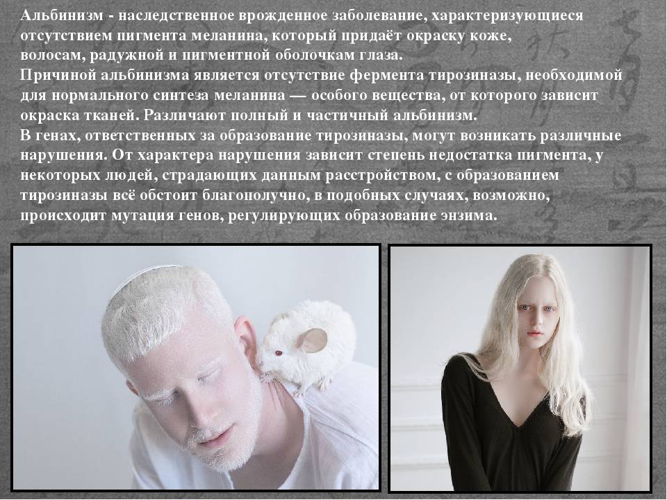 Сообщество пациентов с альбинизмом