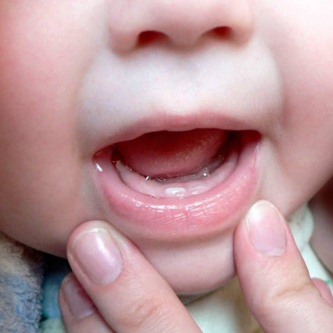 Температура у грудных детей при прорезывании зубов