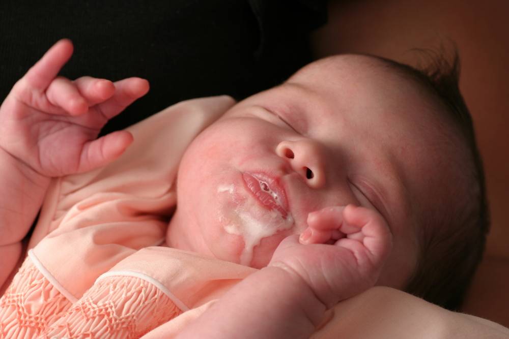 Приснился сон ребёнок срыгнул. срыгивание у младенцев: как отличить, что нормально, а что – нет. рекомендации от детского гастроэнтеролога