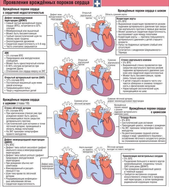 Клиническая картина врожденных пороков сердца у детей