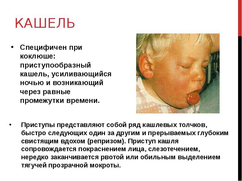 Почему новорожденный хрюкает носом, сопит: что делать