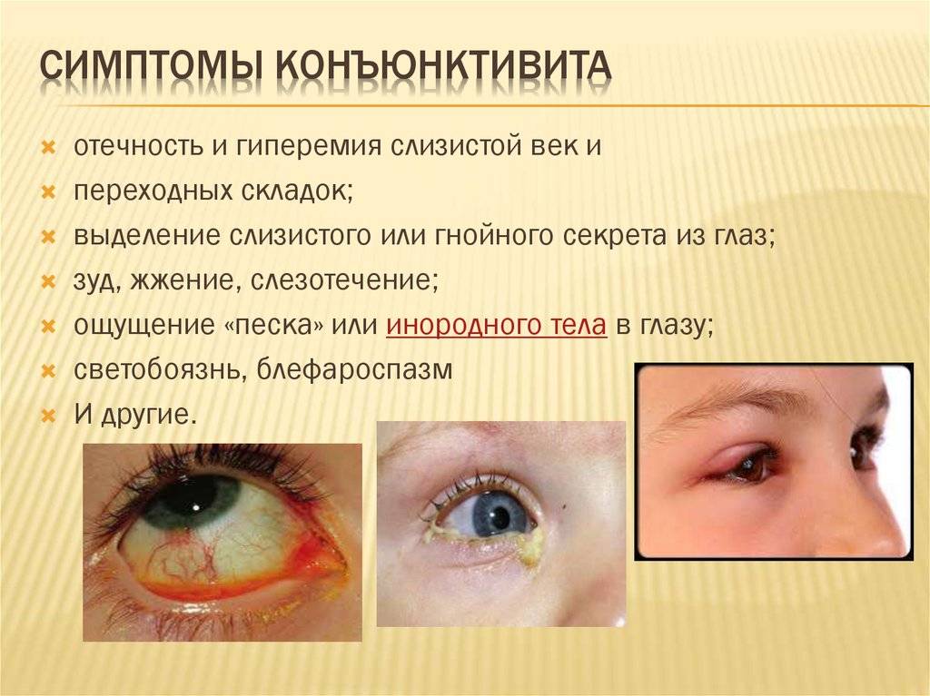 Какие наследственные заболевания глаз существуют?