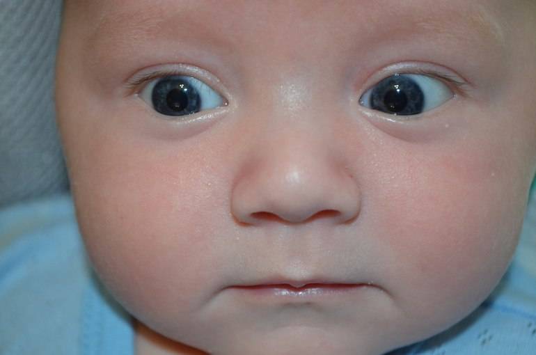 Когда у новорожденного определяется цвет глаз: неисследованная закономерность