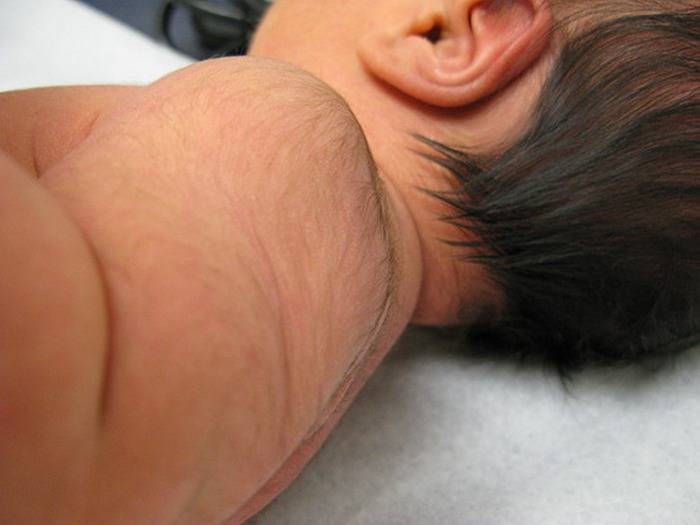 Как убрать волосы на ушах новорожденного