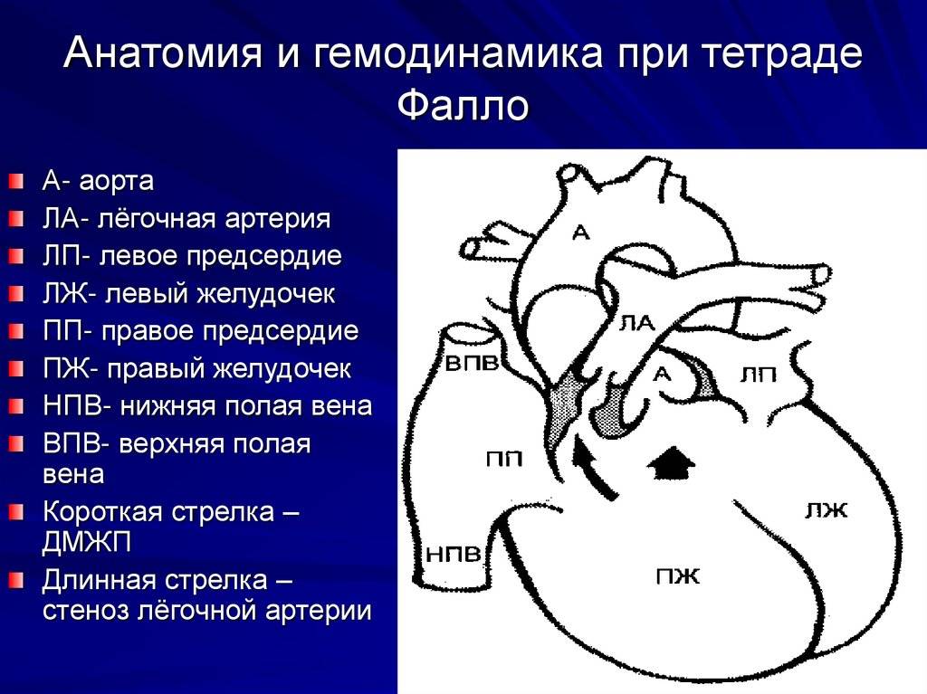 Гемодинамика дмжп у детей схема