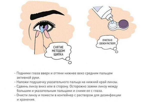 Коррекция зрения контактными линзами «ochkov.net»