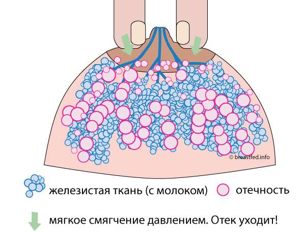Возможные проблемы грудного вскармливания. пути решения.