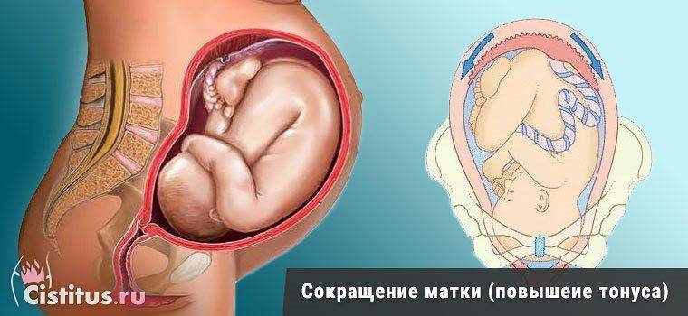Тонус матки во время беременности: признаки, диагностика, лечение