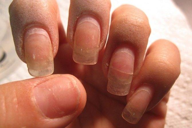 Можно ли во время беременности красить ногти лаком или шеллаком. возможные риски