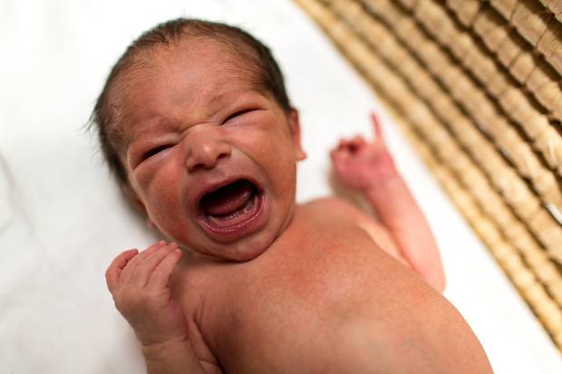 Цианоз у новорожденных причины. цианоз у новорождённых