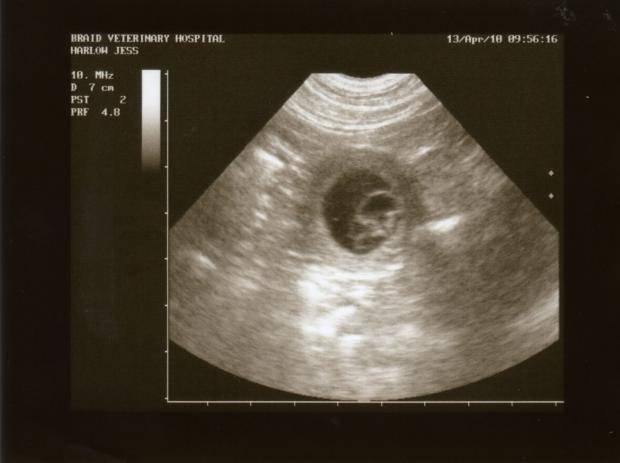 4 неделя беременности: что происходит в 1 месяц от зачатия?