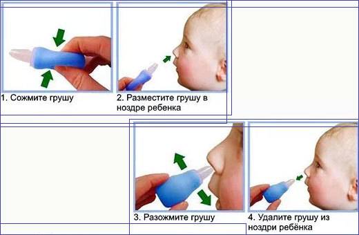 Как правильно промывать нос ребенку в домашних условиях: какие правила соблюдать