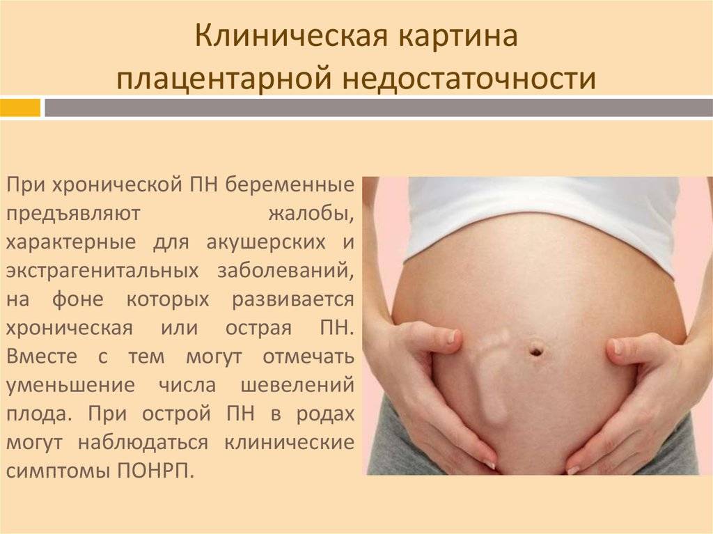 Какие бывают группы риска при беременности?
