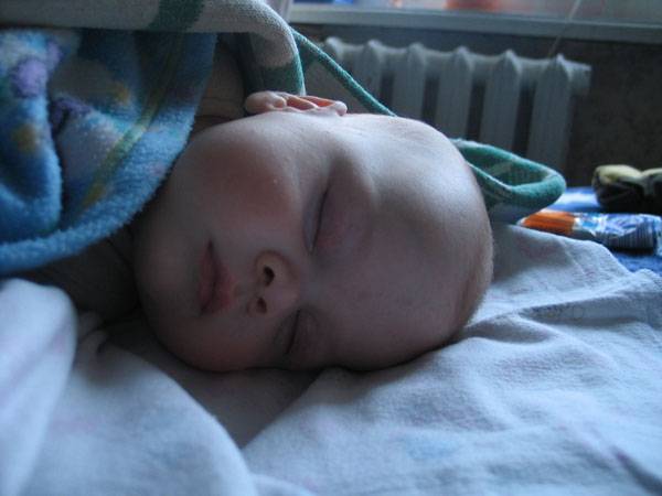 Комаровский – ребенок упал с кровати вниз в 6 месяцев: малыш упал с дивана на пол, последствия, что делать