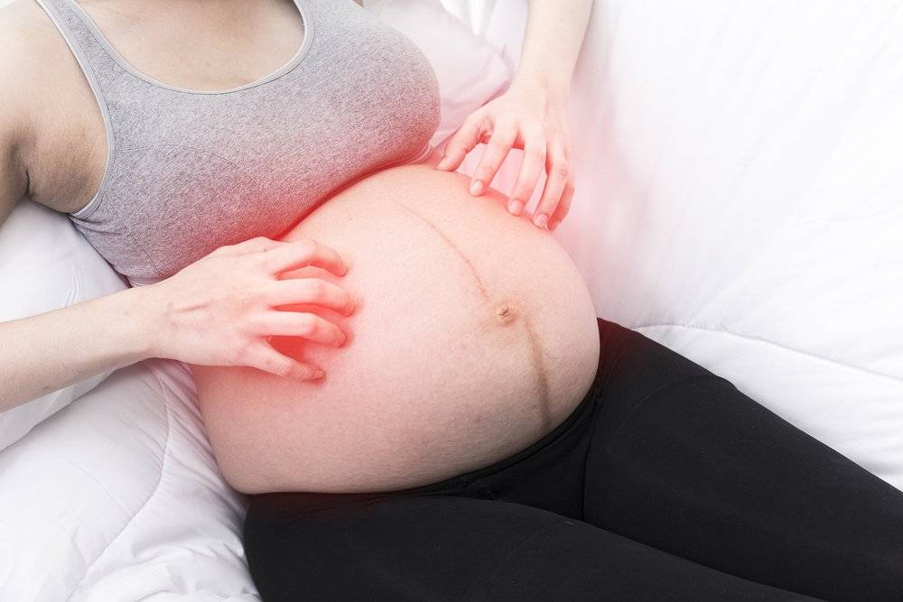 Что делать, если чешется живот при беременности?