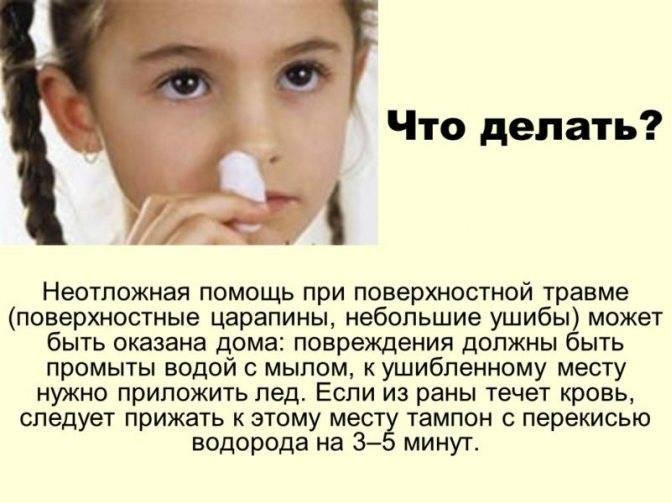 Травма носа - симптомы болезни, профилактика и лечение травмы носа, причины заболевания и его диагностика на eurolab