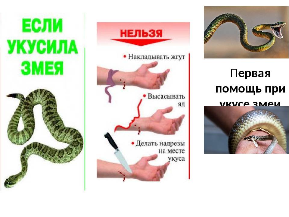 Укусила ядовитая змея: что делать, как оказать помощь, последствия укуса