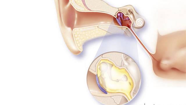 Грибковые заболевания ушей