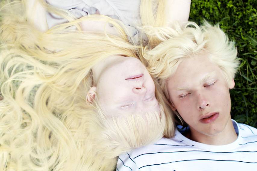 24 факта, которые вы не знали об альбинизме