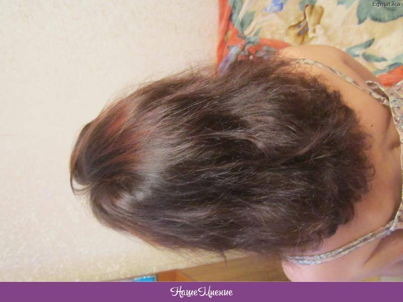 Как справиться с выпадением волос после родов и кормления грудью - центр эстетической медицины