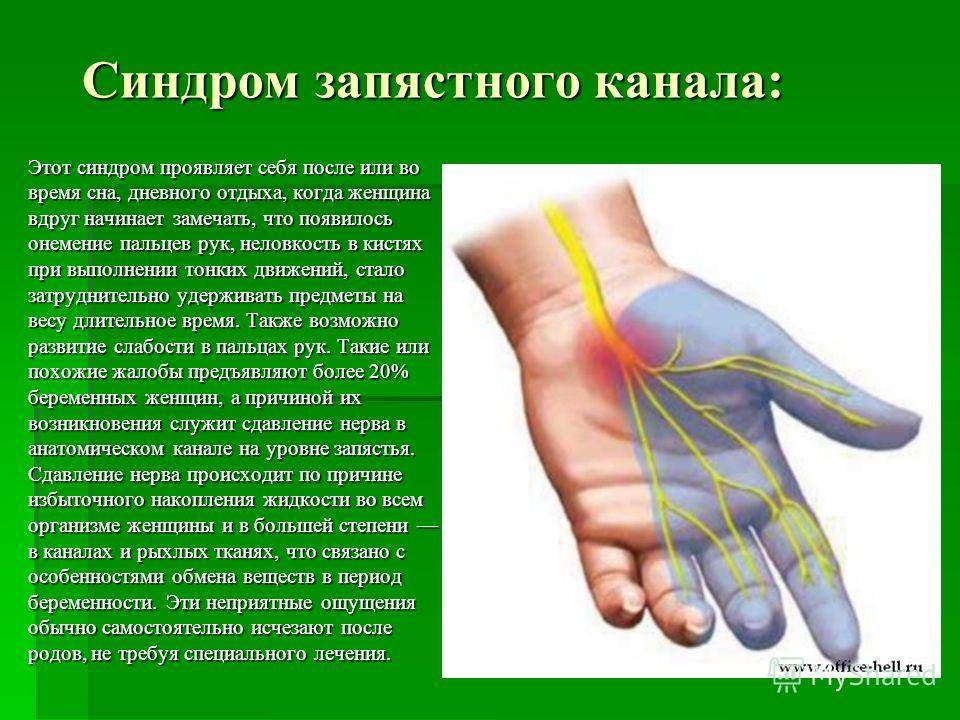 Немеют что делать. Синдром запястного канала. Синдром запястноооканала. Синдром канала запястья. Кистевой туннельный синдром.