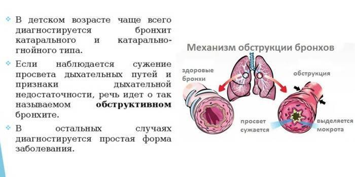 Бронхит педиатрия презентация