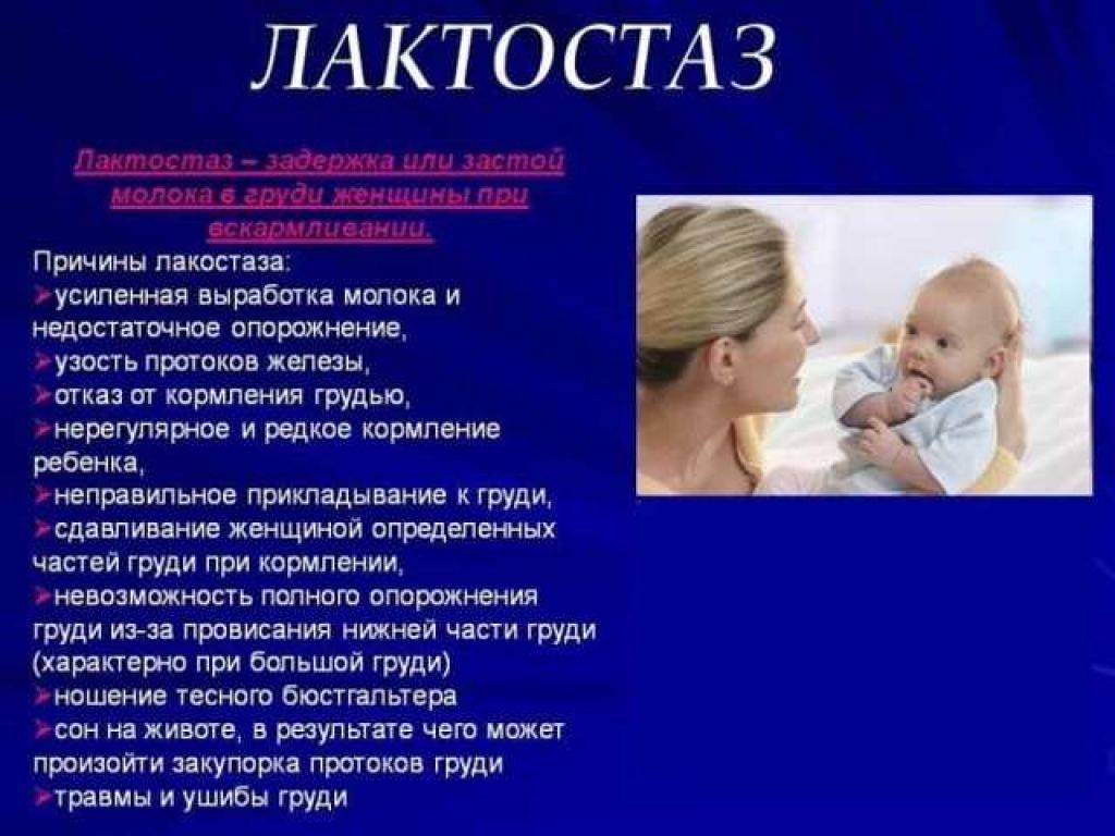 Лактостаз груди у кормящей матери: симптомы, лечение в домашних условиях