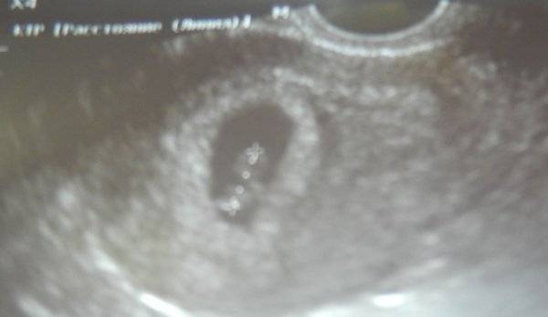 2 неделя беременности: что происходит в 1 месяц от зачатия?