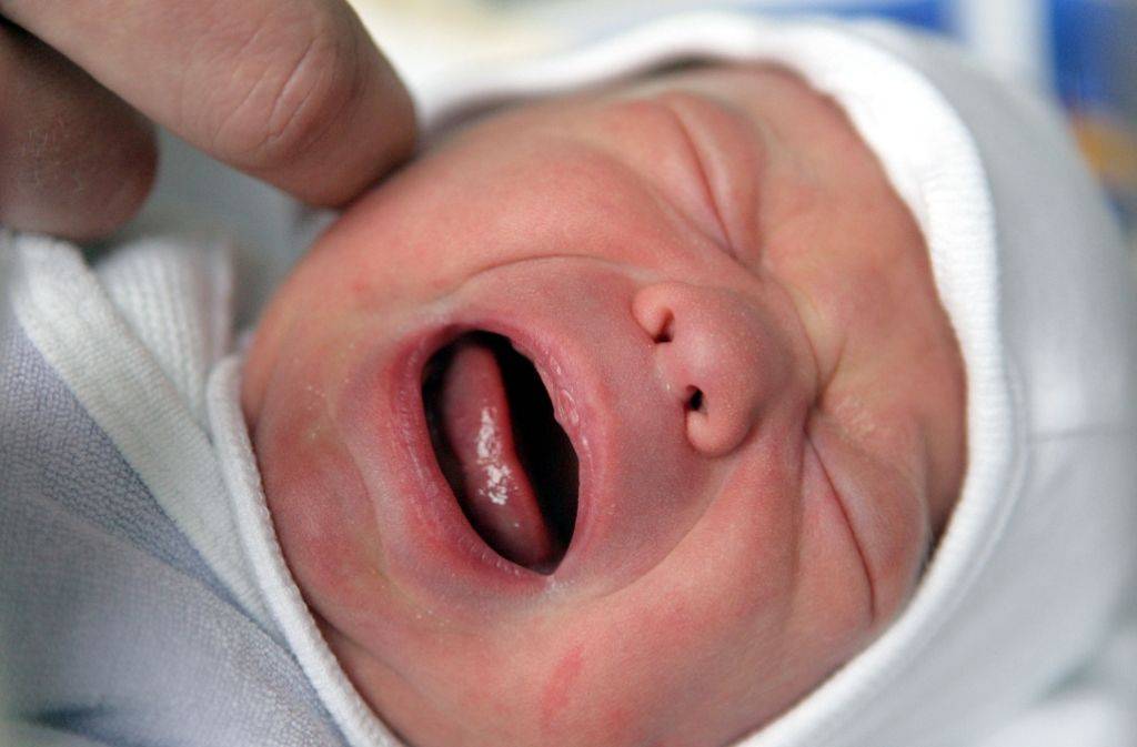 Почему новорожденный ребенок синеет