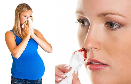 Кровь из носа при беременности: почему идет на раннем сроке, во время второго и третьего триместра, причины носовых кровотечений