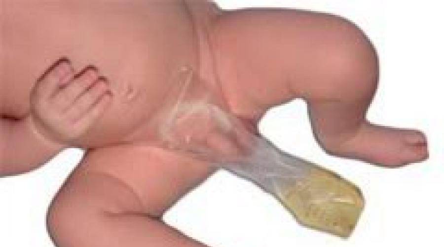 Причины появления следов и сгустков крови в моче у новорожденного и ребенка старше года